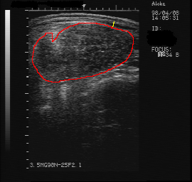 real-time ultrasound image